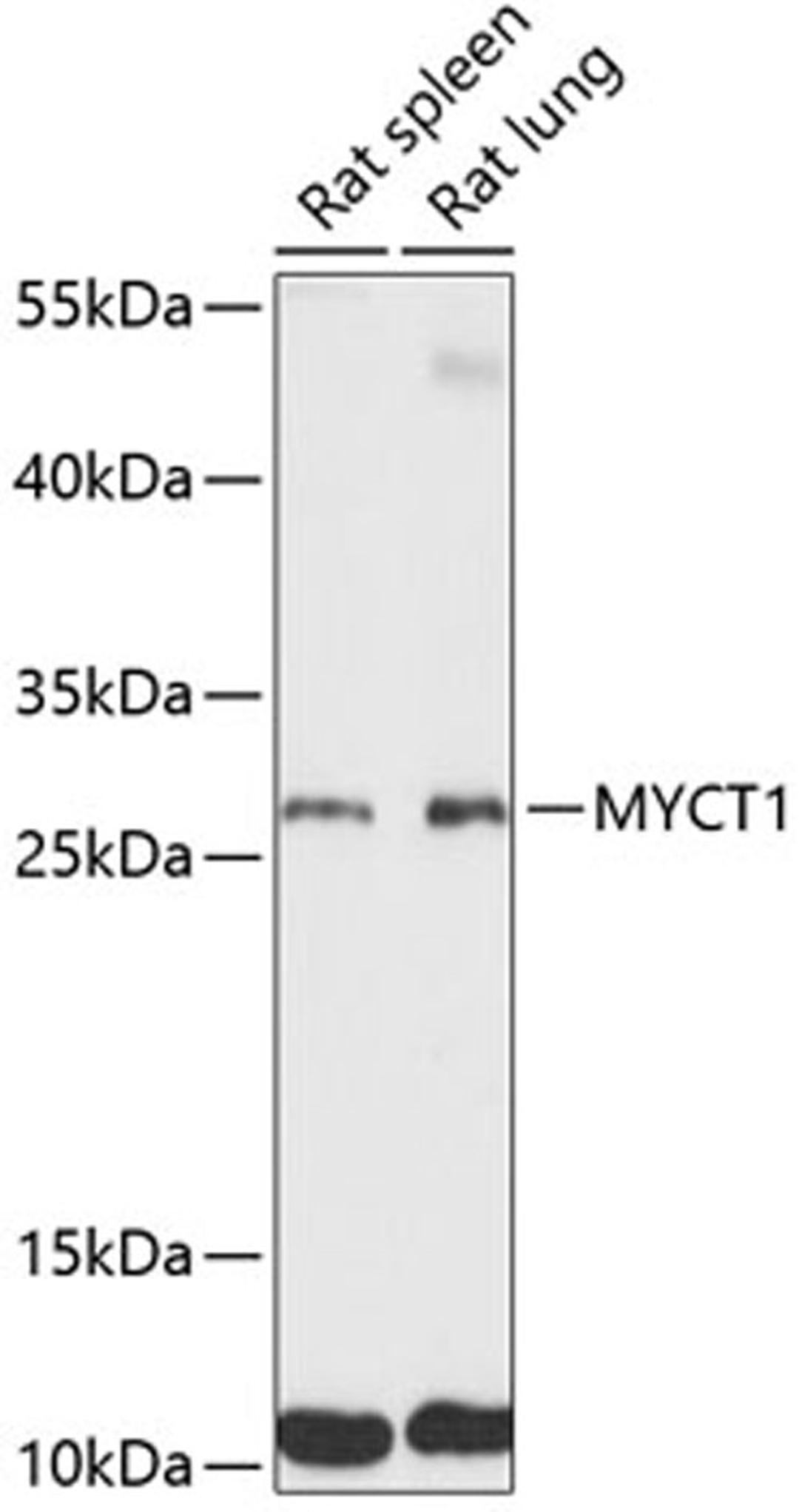 Western blot - MYCT1 antibody (A14541)