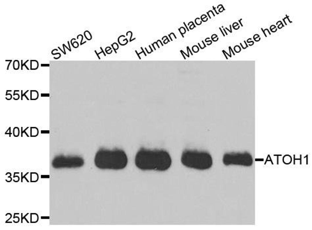 Western blot analysis of extracts of various cell lines using ATOH1 antibody