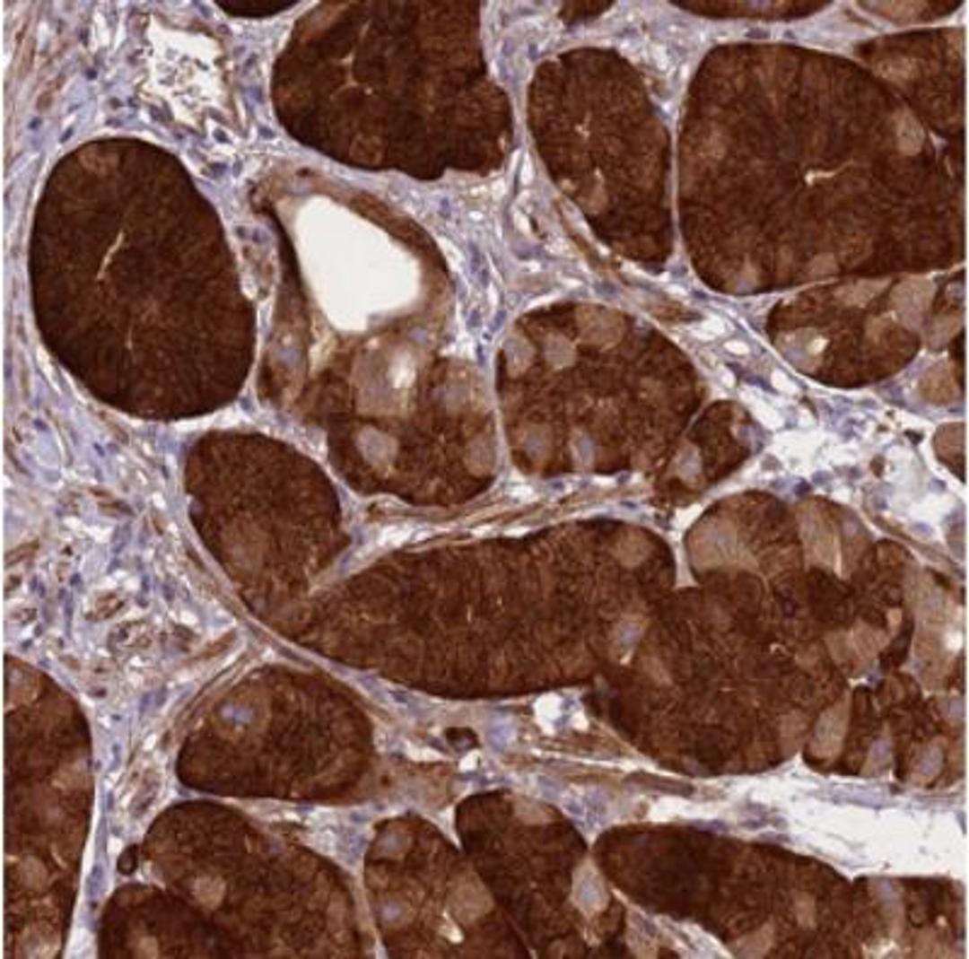 Immunohistochemistry: GEN1 Antibody [NBP2-30783] - Staining of human stomach, upper shows strong cytoplasmic positivity in glandular cells.