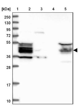 Western Blot: HOMER2 Antibody [NBP1-85487] - Lane 1: Marker [kDa] 250, 130, 95, 72, 55, 36, 28, 17, 10<br/>Lane 2: Human cell line RT-4<br/>Lane 3: Human cell line U-251MG sp<br/>Lane 4: Human plasma (IgG/HSA depleted)<br/>Lane 5: Human liver tissue