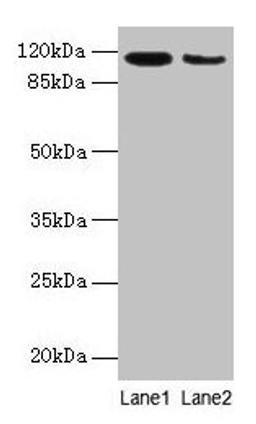 Western blot. All lanes: ATP2A2 antibody at 6µg/ml. Lane 1: Mouse heart tissue. Lane 2: Mouse skeletal muscle tissue. Secondary. Goat polyclonal to rabbit IgG at 1/10000 dilution. Predicted band size: 115, 110, 112 kDa. Observed band size: 115 kDa
