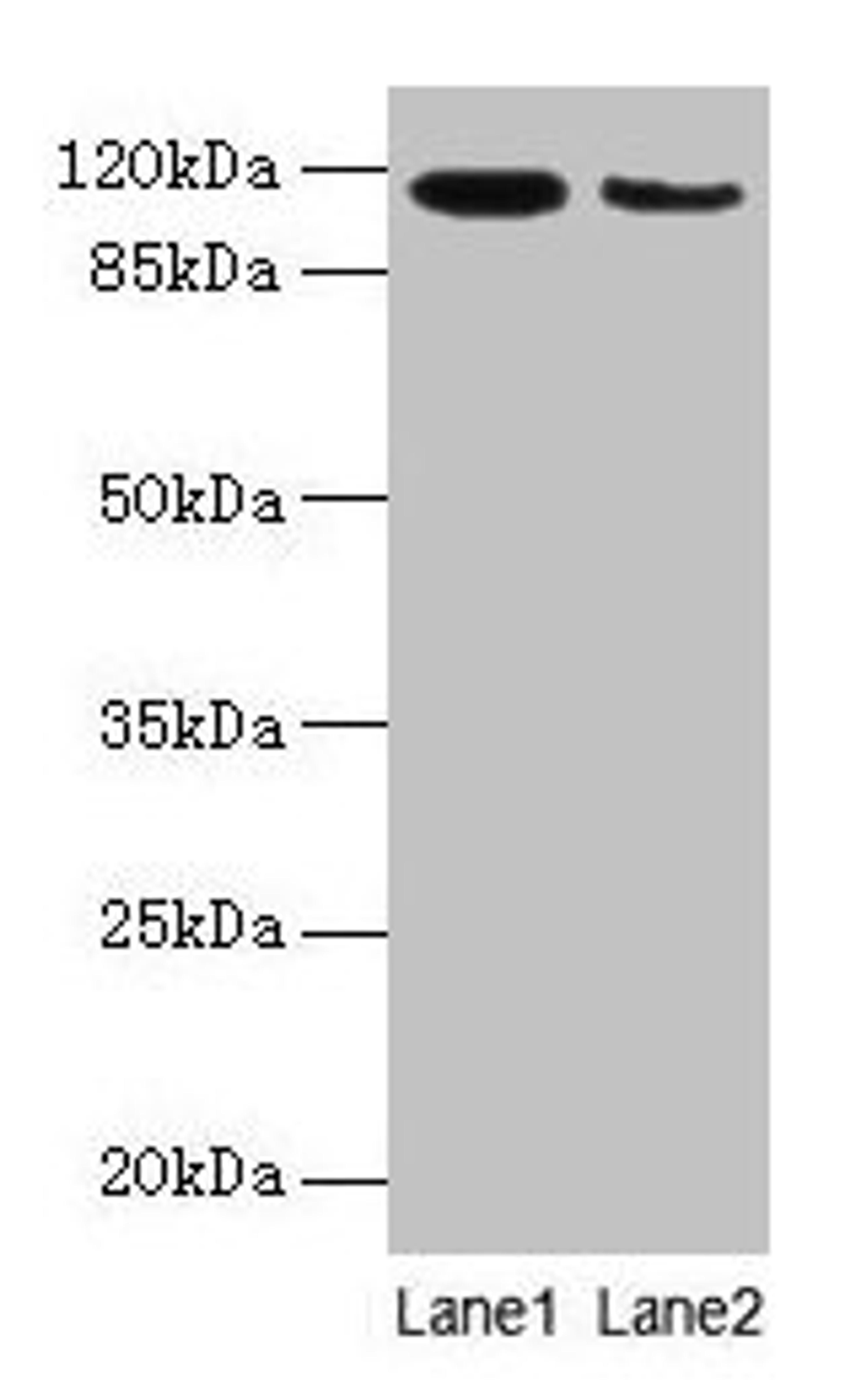 Western blot. All lanes: ATP2A2 antibody at 6µg/ml. Lane 1: Mouse heart tissue. Lane 2: Mouse skeletal muscle tissue. Secondary. Goat polyclonal to rabbit IgG at 1/10000 dilution. Predicted band size: 115, 110, 112 kDa. Observed band size: 115 kDa
