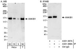 Detection of human ANKIB1 by western blot and immunoprecipitation.