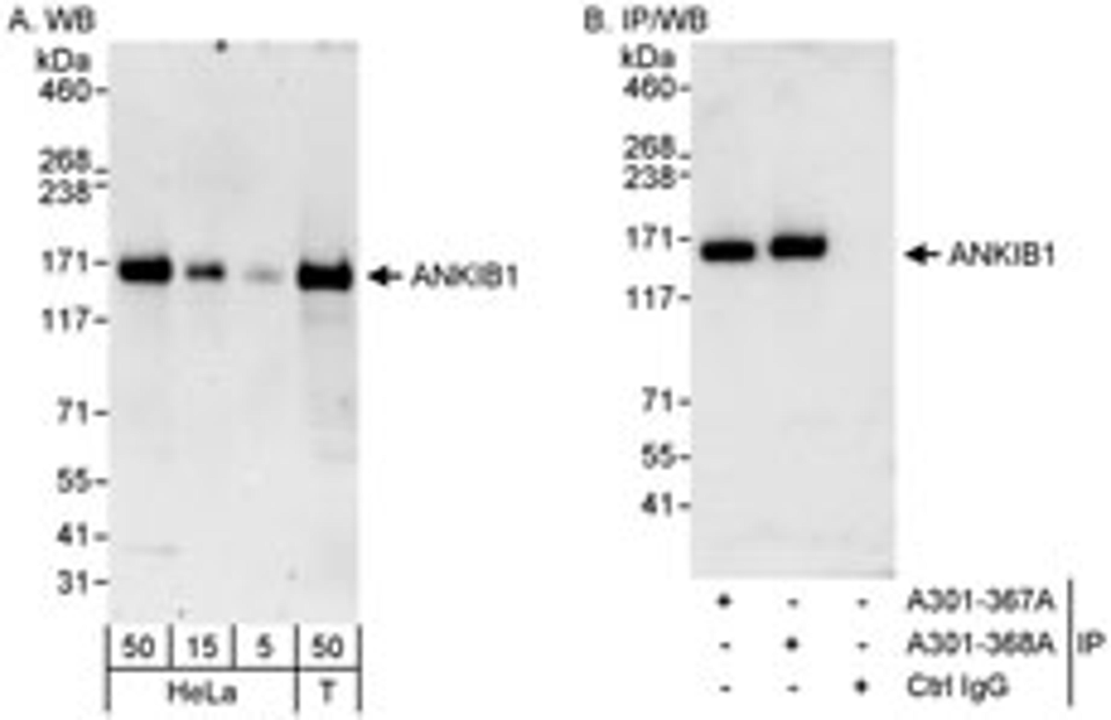 Detection of human ANKIB1 by western blot and immunoprecipitation.