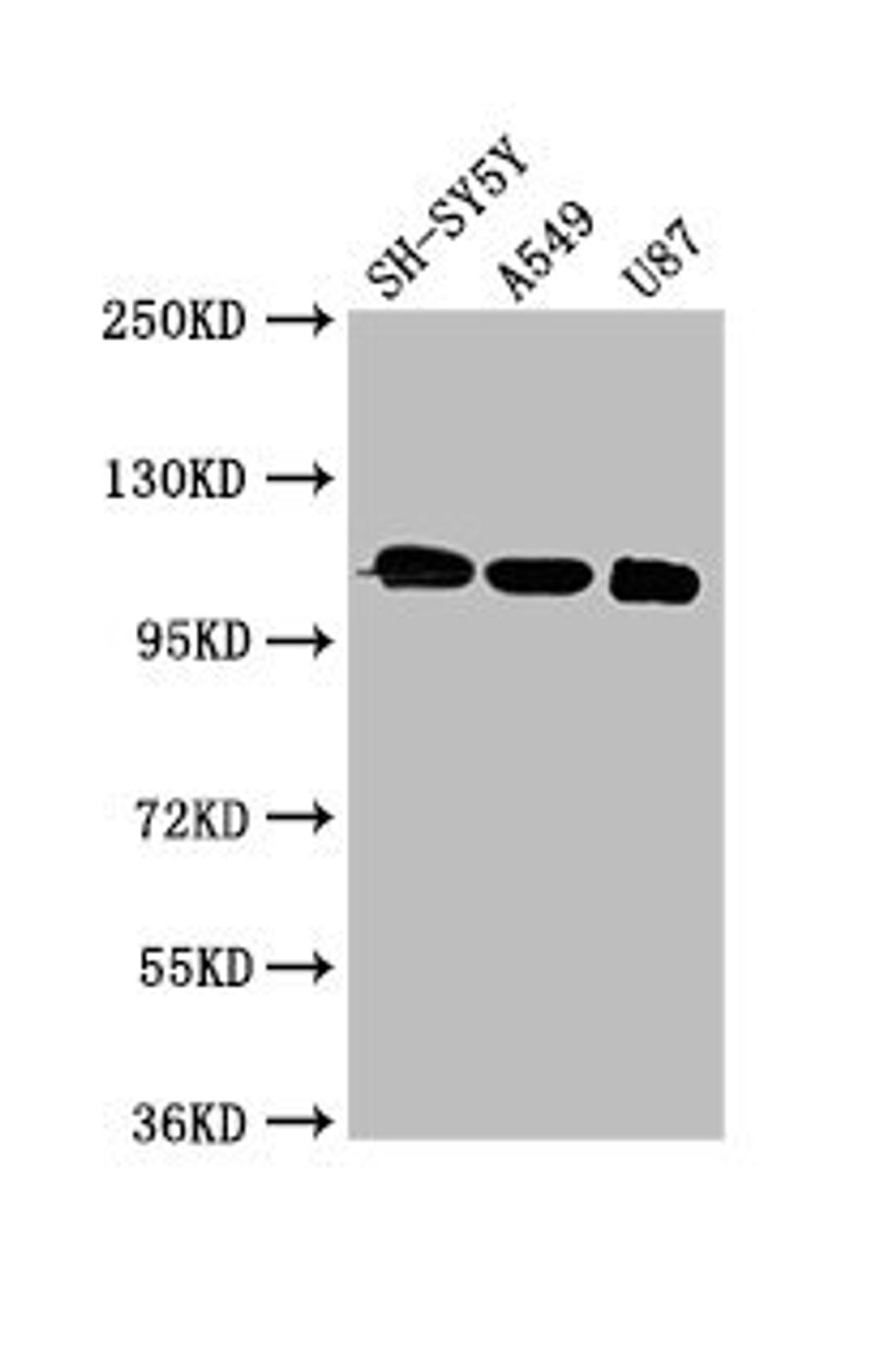 Western Blot. Positive WB detected in: SH-SY5Y whole cell lysate, A549 whole cell lysate, U87 whole cell lysate. All lanes: LRP8 antibody at 3µg/ml. Secondary. Goat polyclonal to rabbit IgG at 1/50000 dilution. Predicted band size: 106, 78, 100, 88 kDa. Observed band size: 106 kDa
