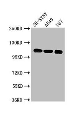 Western Blot. Positive WB detected in: SH-SY5Y whole cell lysate, A549 whole cell lysate, U87 whole cell lysate. All lanes: LRP8 antibody at 3µg/ml. Secondary. Goat polyclonal to rabbit IgG at 1/50000 dilution. Predicted band size: 106, 78, 100, 88 kDa. Observed band size: 106 kDa
