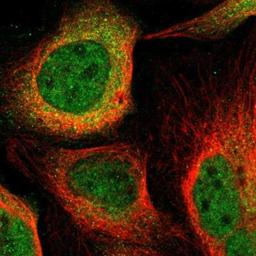 Immunocytochemistry/Immunofluorescence: ABCA3 Antibody [NBP1-89310] - Staining of human cell line U-2 OS shows positivity in nucleus but not nucleoli & cytoplasm.