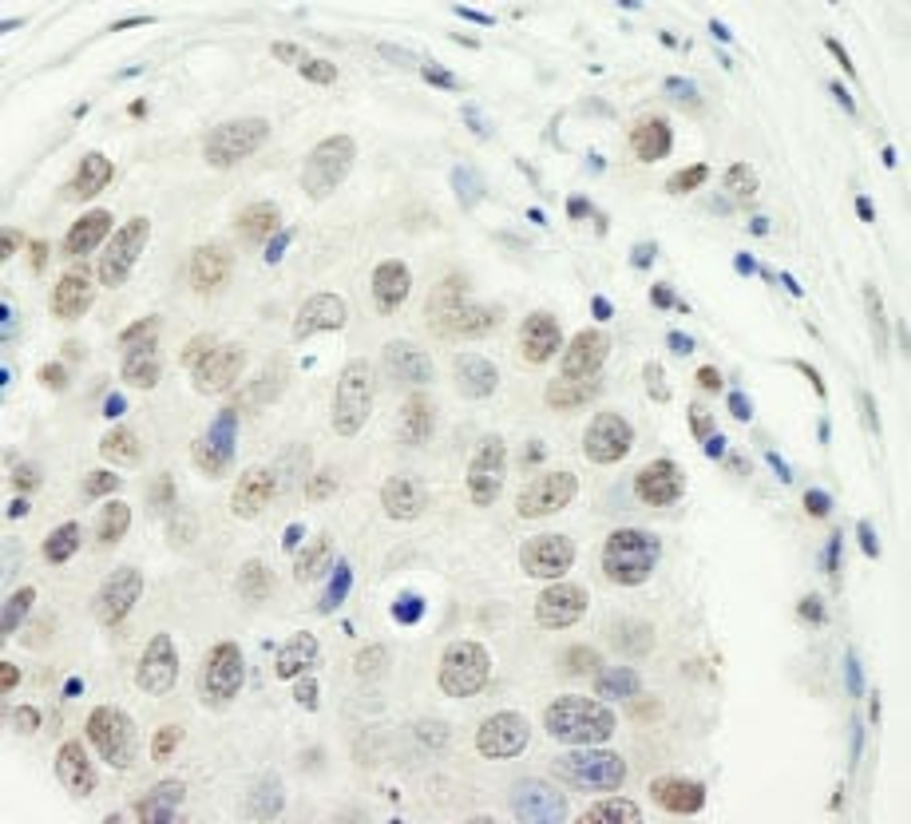 Detection of human ZC3H11A by immunohistochemistry.