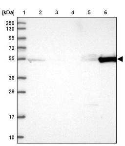 Western Blot: PCTAIRE3 Antibody [NBP1-92249] - Lane 1: Marker [kDa] 250, 130, 95, 72, 55, 36, 28, 17, 10<br/>Lane 2: Human cell line RT-4<br/>Lane 3: Human cell line U-251MG sp<br/>Lane 4: Human plasma (IgG/HSA depleted)<br/>Lane 5: Human liver tissue<br/>Lane 6: Human tonsil tissue