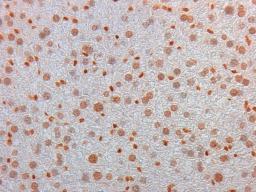 Immunohistochemical staining of Mouse Liver tissue using AKT3 PE antibody (RPE)