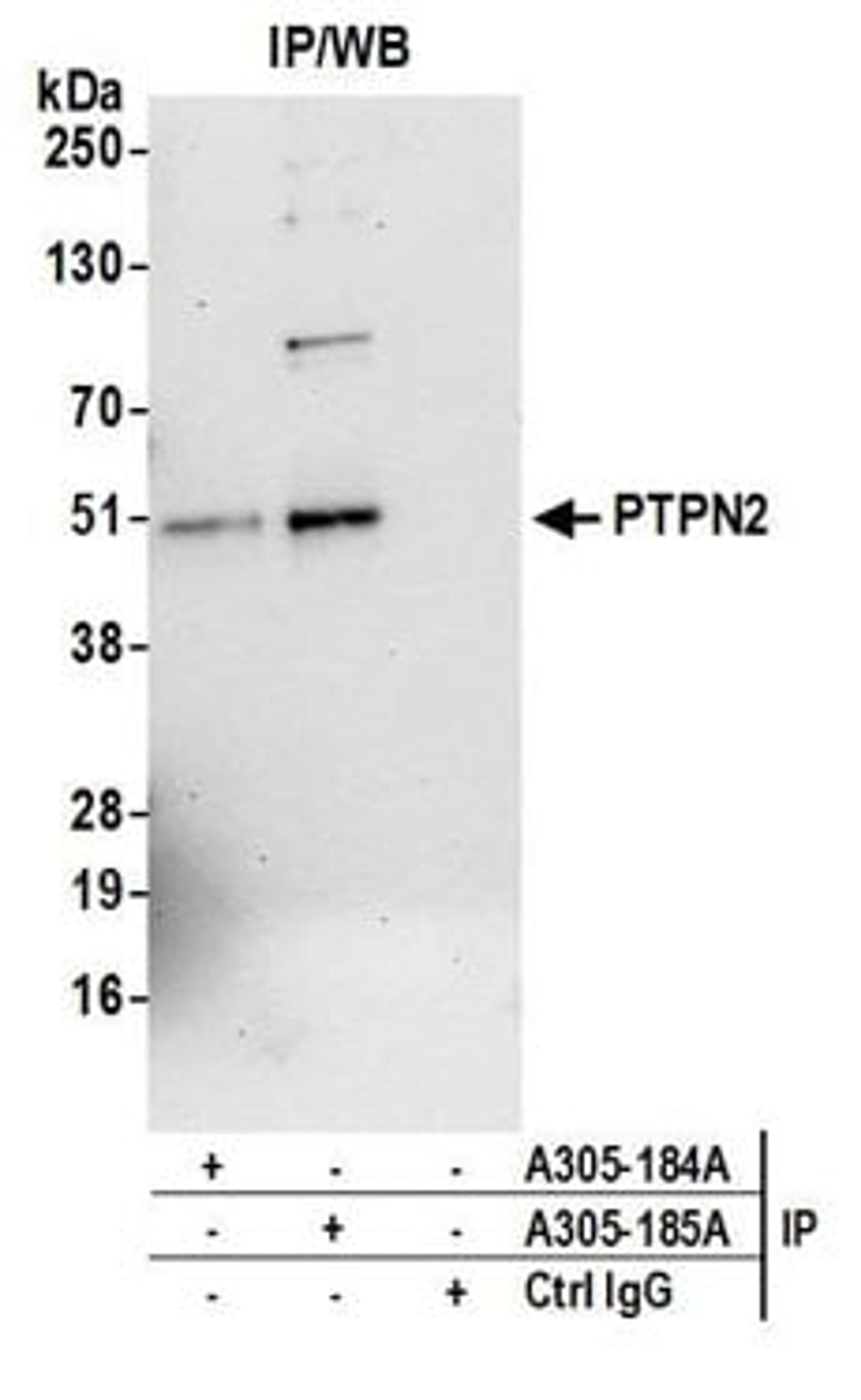 Detection of human PTPN2 by western blot of immunoprecipitates.