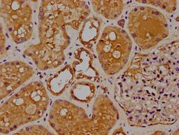 IHC image of CSB-PA861994LA01HU diluted at 1:100 and staining in paraffin-embedded human kidney tissue performed on a Leica BondTM system. After dewaxing and hydration, antigen retrieval was mediated by high pressure in a citrate buffer (pH 6.0). Section was blocked with 10% normal goat serum 30min at RT. Then primary antibody (1% BSA) was incubated at 4°C overnight. The primary is detected by a biotinylated secondary antibody and visualized using an HRP conjugated SP system.