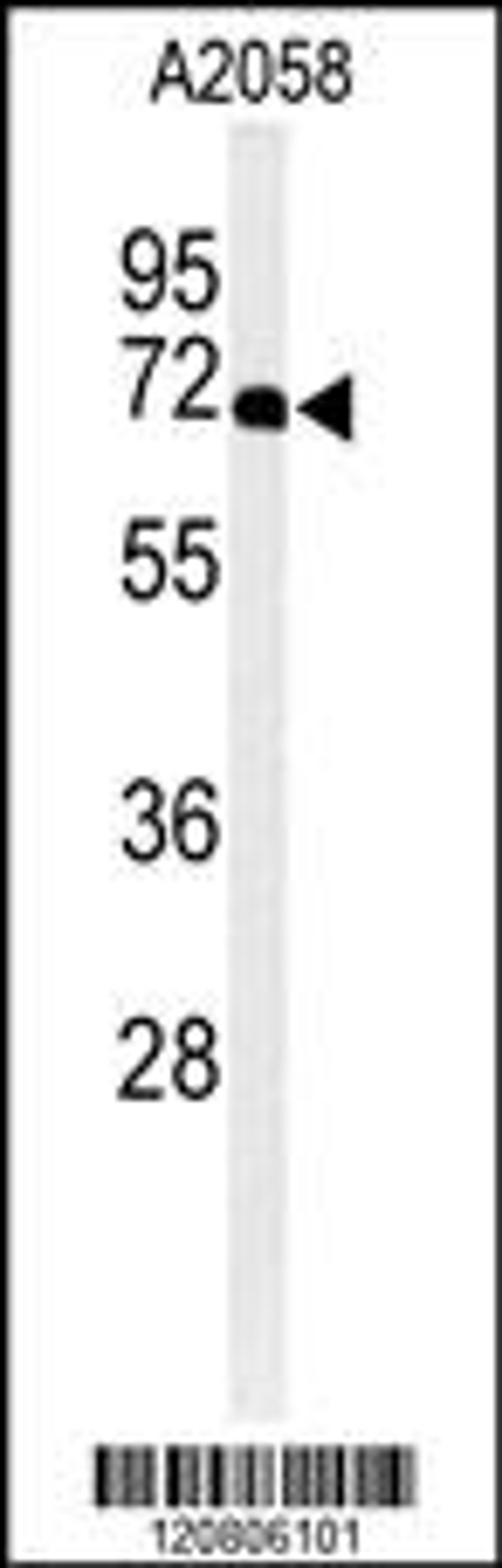 Western blot analysis of XRCC6 Antibody in A2058 cell line lysates (35ug/lane)