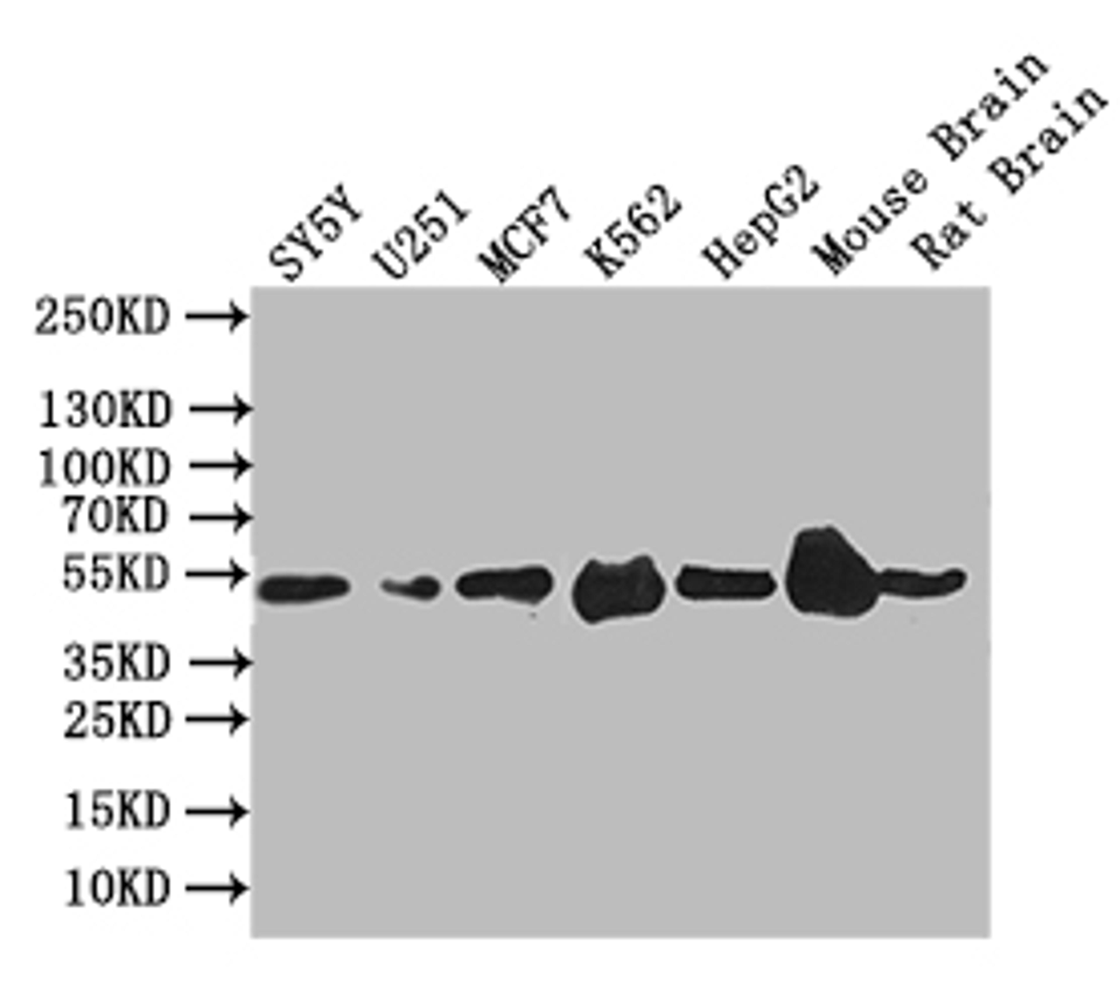 Western Blot. Positive WB detected in: SY5Y whole cell lysate,U251 whole cell lysate,MCF7 whole cell lysate,K562 whole cell lysate,Mouse Brain tissue lysate,Mouse Brain tissue lysate. All lanes: EGR2 antibody at 1:1000. Secondary. Goat polyclonal to rabbit IgG at 1/50000 dilution. Predicted band size: 50 kDa. Observed band size: 50 kDa.