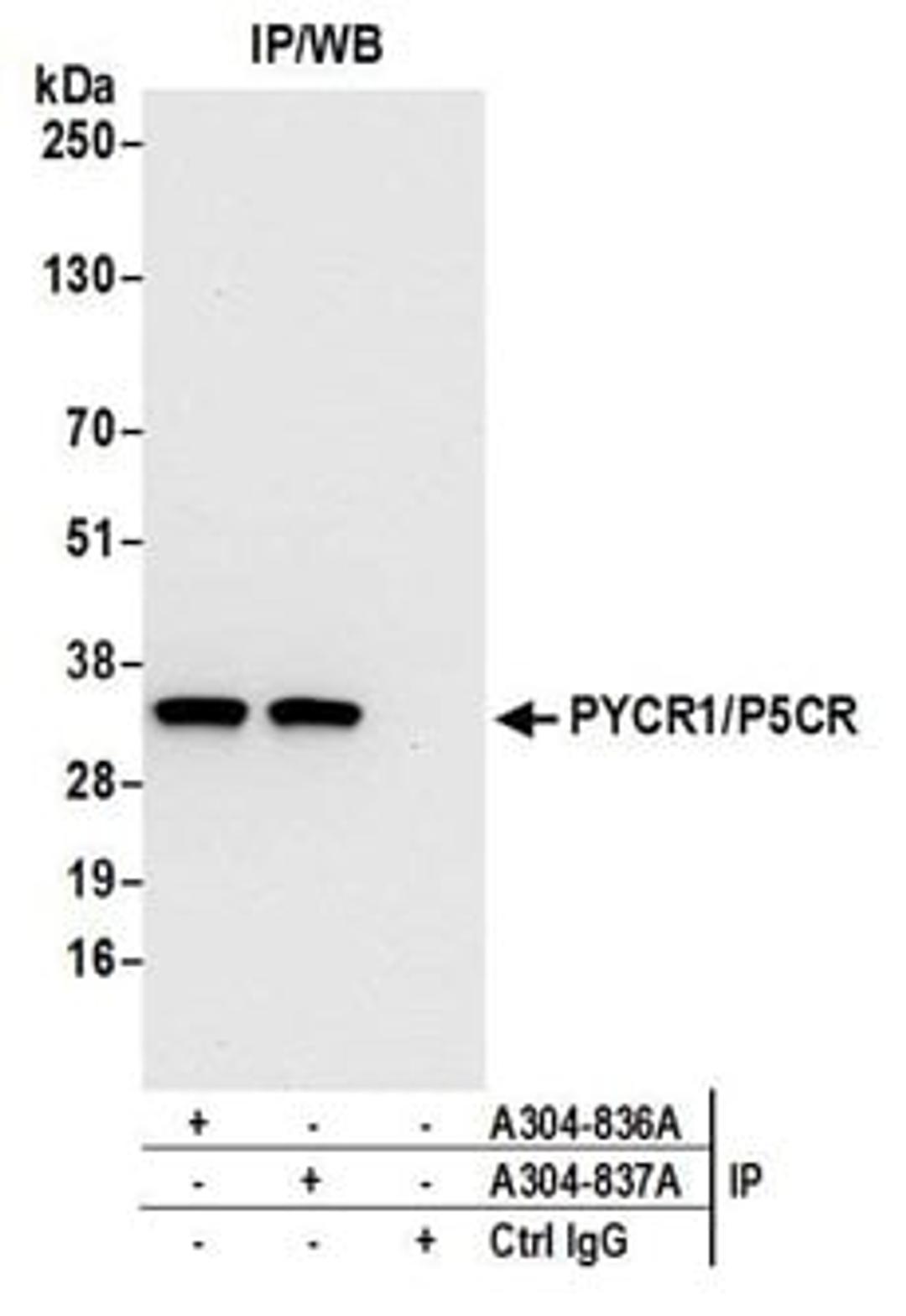 Detection of human PYCR1/P5CR by western blot of immunoprecipitates.