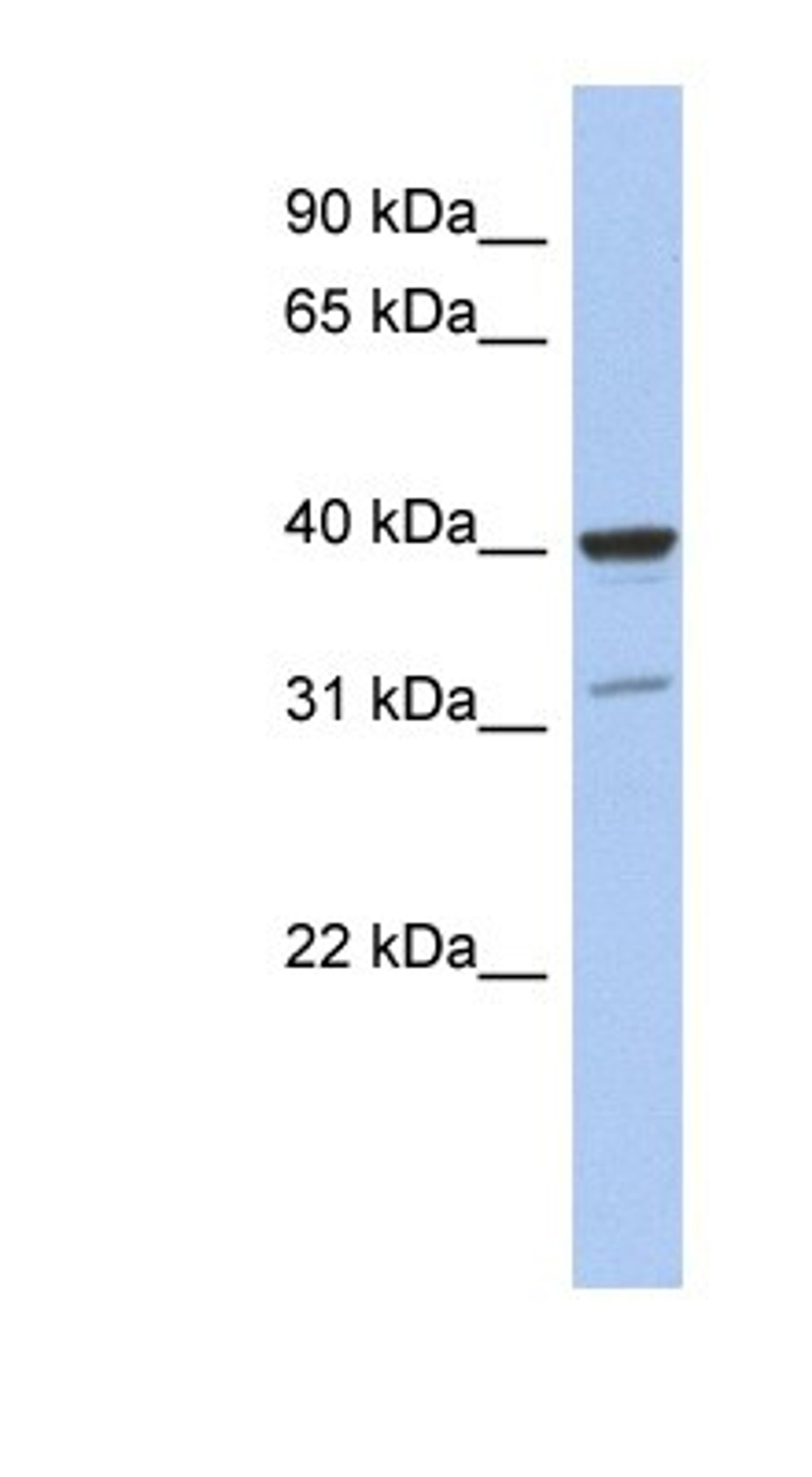 Western Blot: Thrombopoietin Antibody [NBP1-59293] - MCF-7 whole cell lysates, concentration 0.2-1 ug/ml.