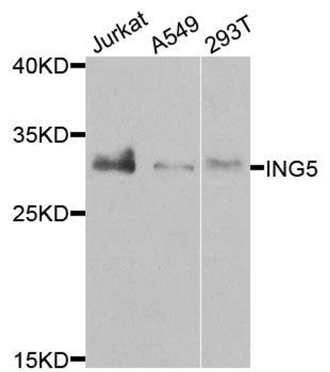 Western blot analysis of extracts of various cells using ING5 antibody