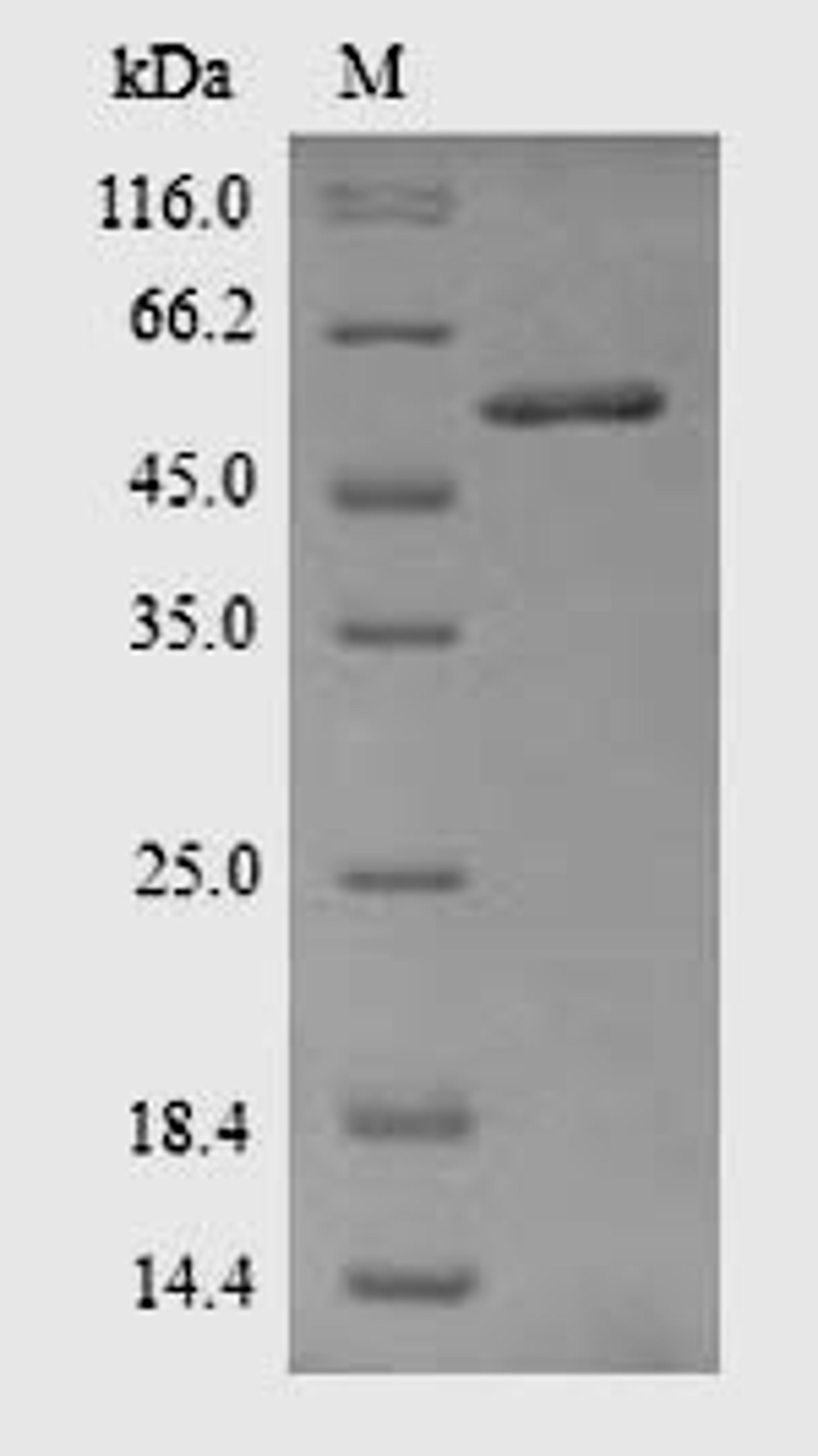 (Tris-Glycine gel) Discontinuous SDS-PAGE (reduced) with 5% enrichment gel and 15% separation gel.