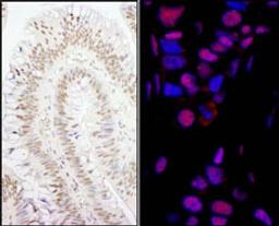 Detection of human PPP4R3 Alpha by immunohistochemistry.