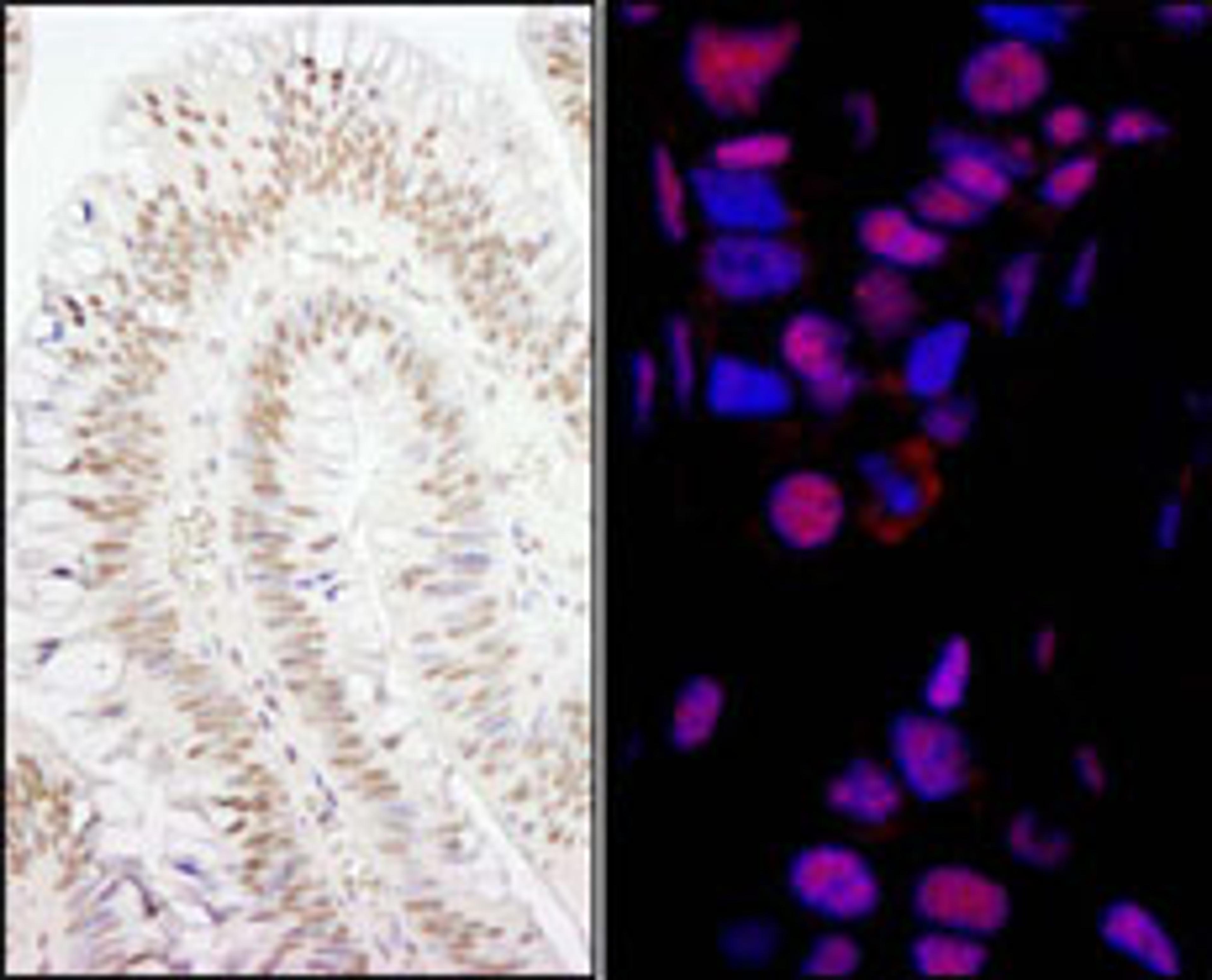 Detection of human PPP4R3 Alpha by immunohistochemistry.