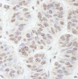 Detection of human GNL3 by immunohistochemistry.