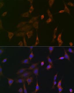 Immunofluorescence - KRAS+HRAS+NRAS Rabbit mAb (A19779)