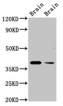 Western Blot. Positive WB detected in: Rat brain tissue, Mouse brain tissue. All lanes: TAAR5 antibody at 3ug/ml. Secondary. Goat polyclonal to rabbit IgG at 1/50000 dilution. Predicted band size: 39 kDa. Observed band size: 39 kDa.