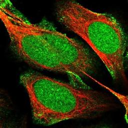 Immunocytochemistry/Immunofluorescence: mpp8 Antibody [NBP1-92135] - Staining of human cell line U-2 OS shows positivity in nucleus, nucleoli & plasma membrane.