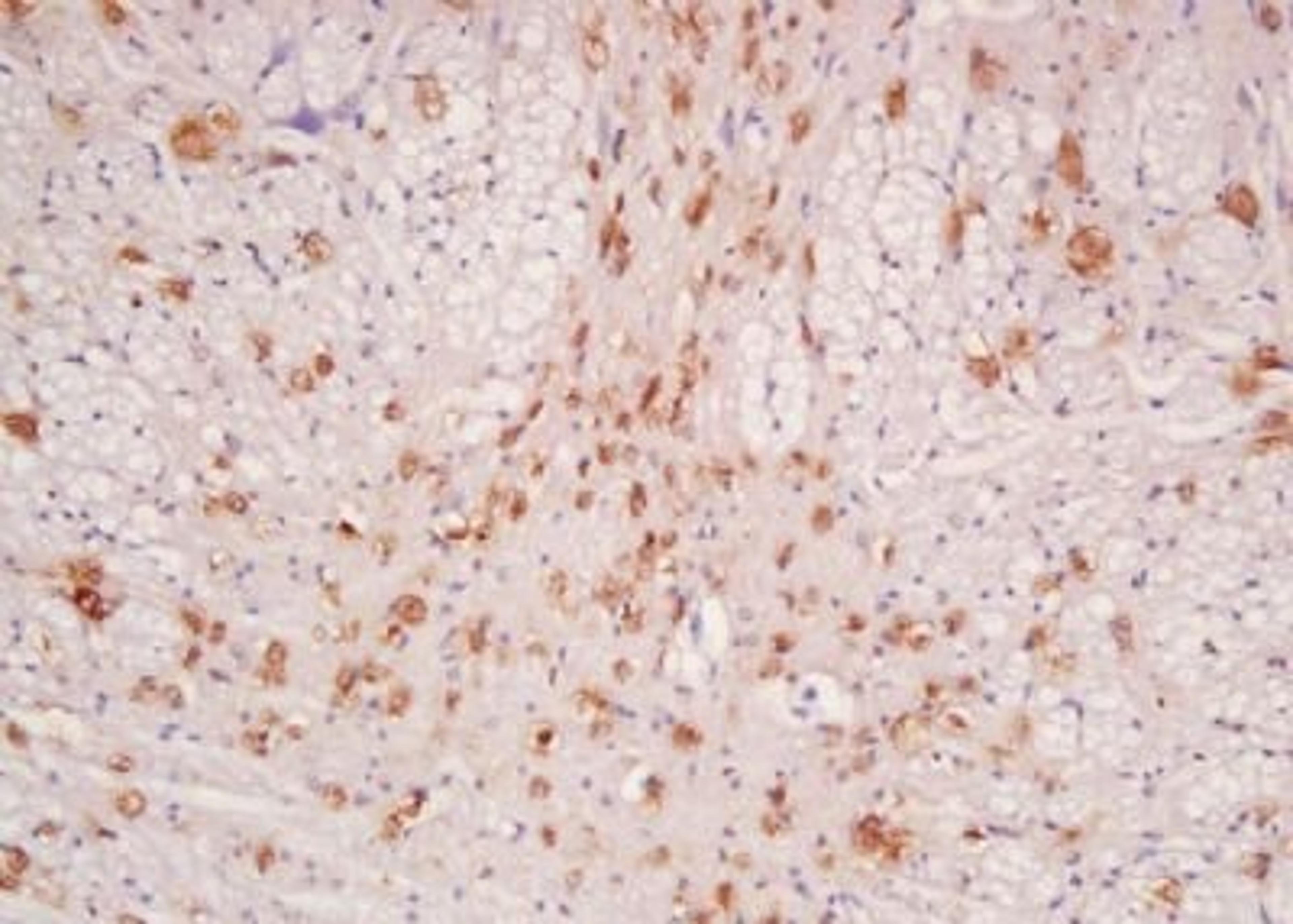 Immunohistochemical analysis of formalin-fixed paraffin embedded rat brain tissue using HER4 antibody (dilution at 1:200)