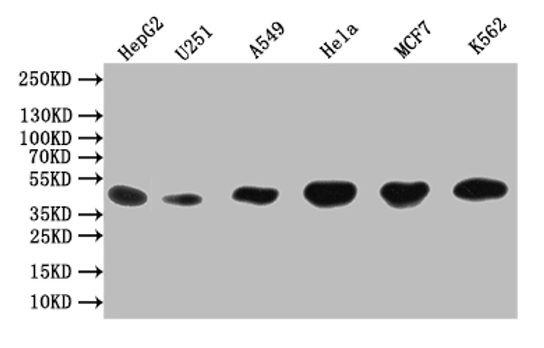 Western Blot. Positive WB detected in: PC-3 whole cell lysate, Mouse liver tissue. All lanes: DGAT2 antibody at 3ug/ml. Secondary. Goat polyclonal to rabbit IgG at 1/50000 dilution. Predicted band size: 44, 40 kDa. Observed band size: 44 kDa.