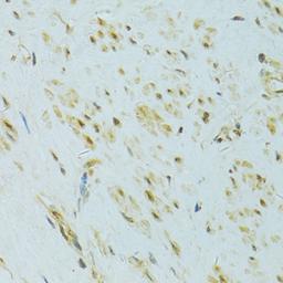 Immunohistochemistry - XBP1 antibody (A14651)