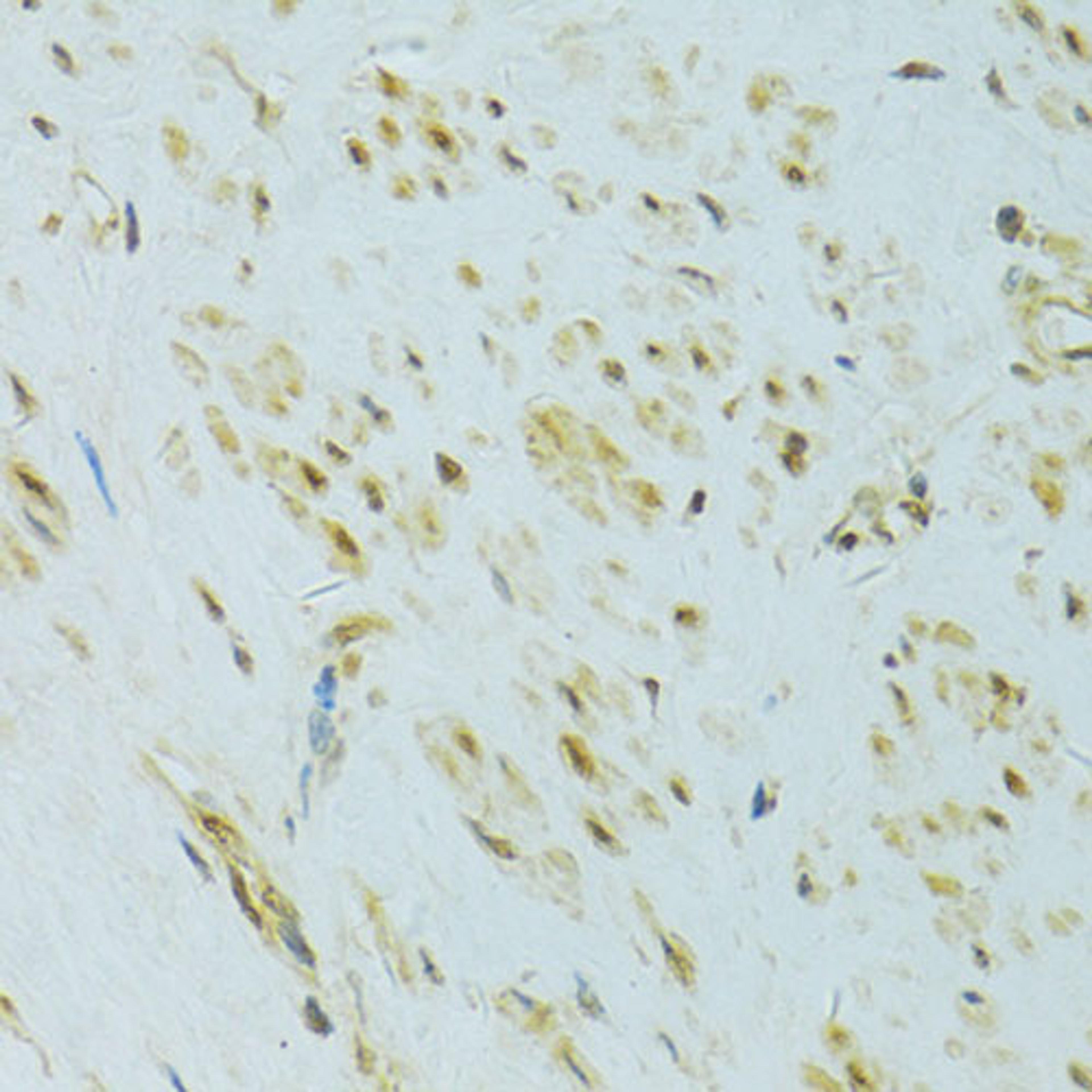 Immunohistochemistry - XBP1 antibody (A14651)