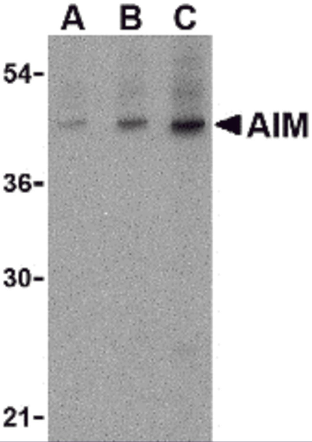 Western blot analysis of AIM in human lymph node tissue lysate with AIM antibody at (A) 1, (B) 2 and (C) 4 μg/mL.
