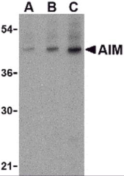 Western blot analysis of AIM in human lymph node tissue lysate with AIM antibody at (A) 1, (B) 2 and (C) 4 μg/mL.