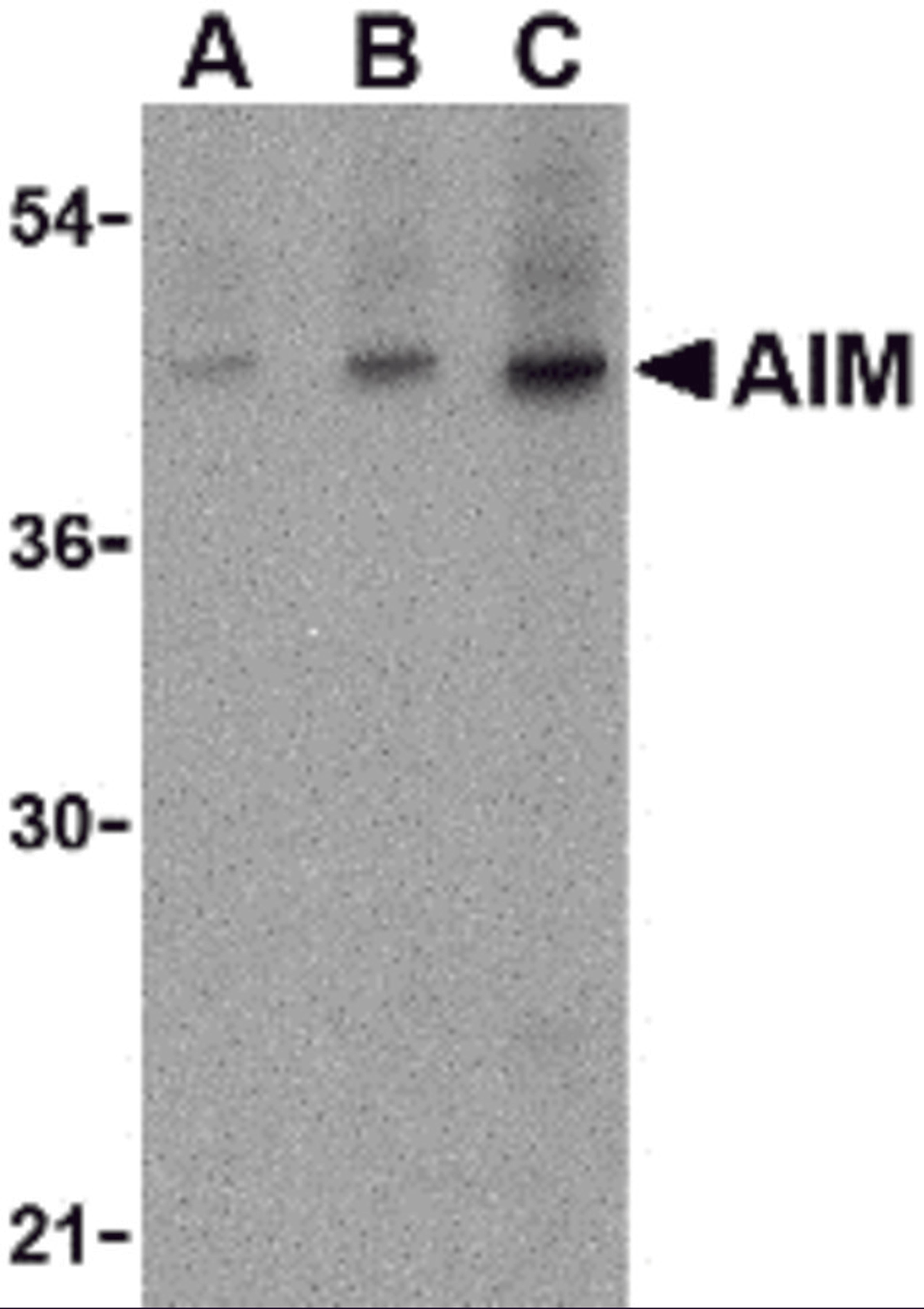 Western blot analysis of AIM in human lymph node tissue lysate with AIM antibody at (A) 1, (B) 2 and (C) 4 μg/mL.