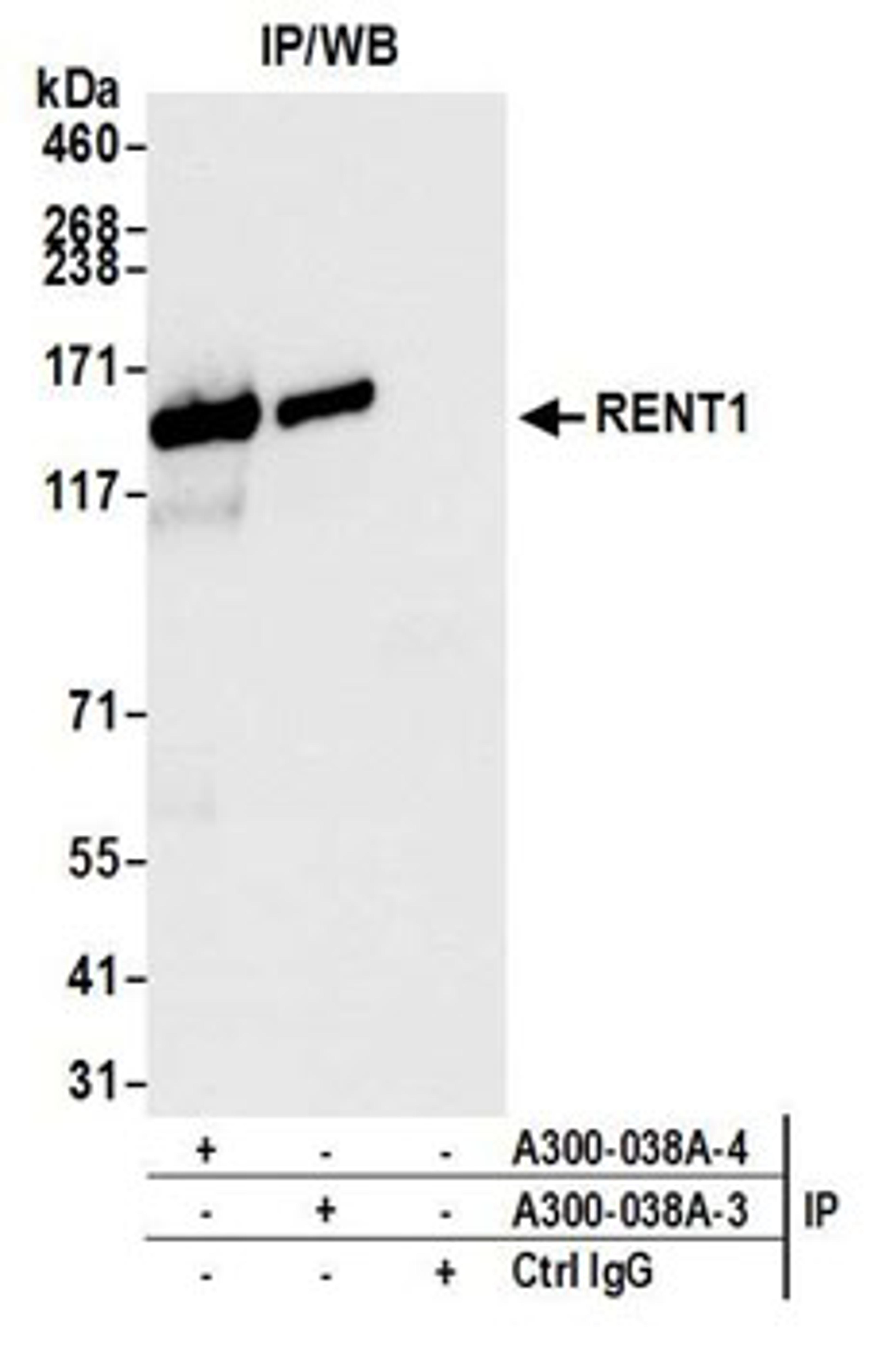 Detection of human RENT1 by western blot of immunoprecipitates.