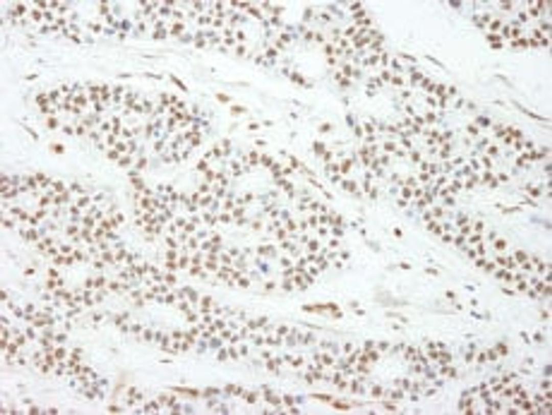 Detection of human MAD2 by immunohistochemistry.