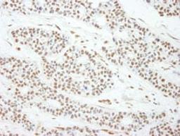 Detection of human MAD2 by immunohistochemistry.