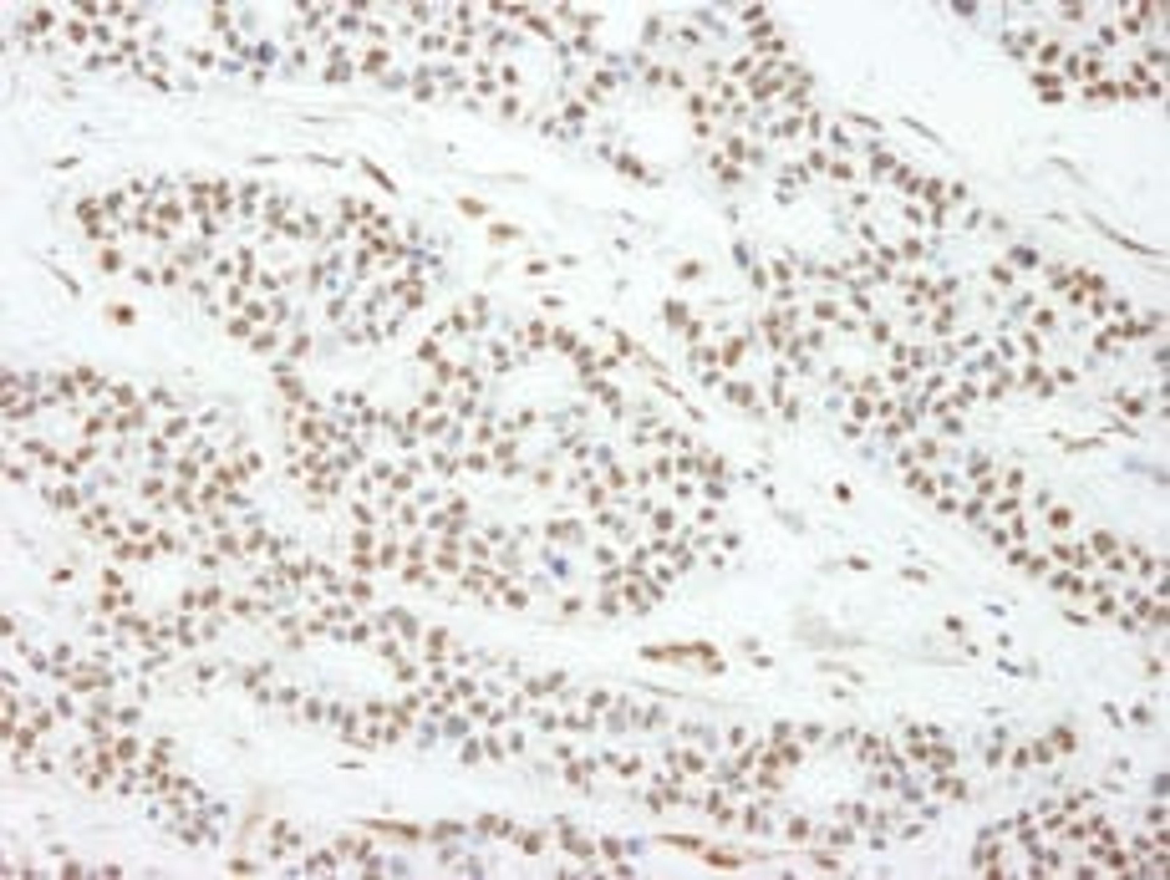 Detection of human MAD2 by immunohistochemistry.