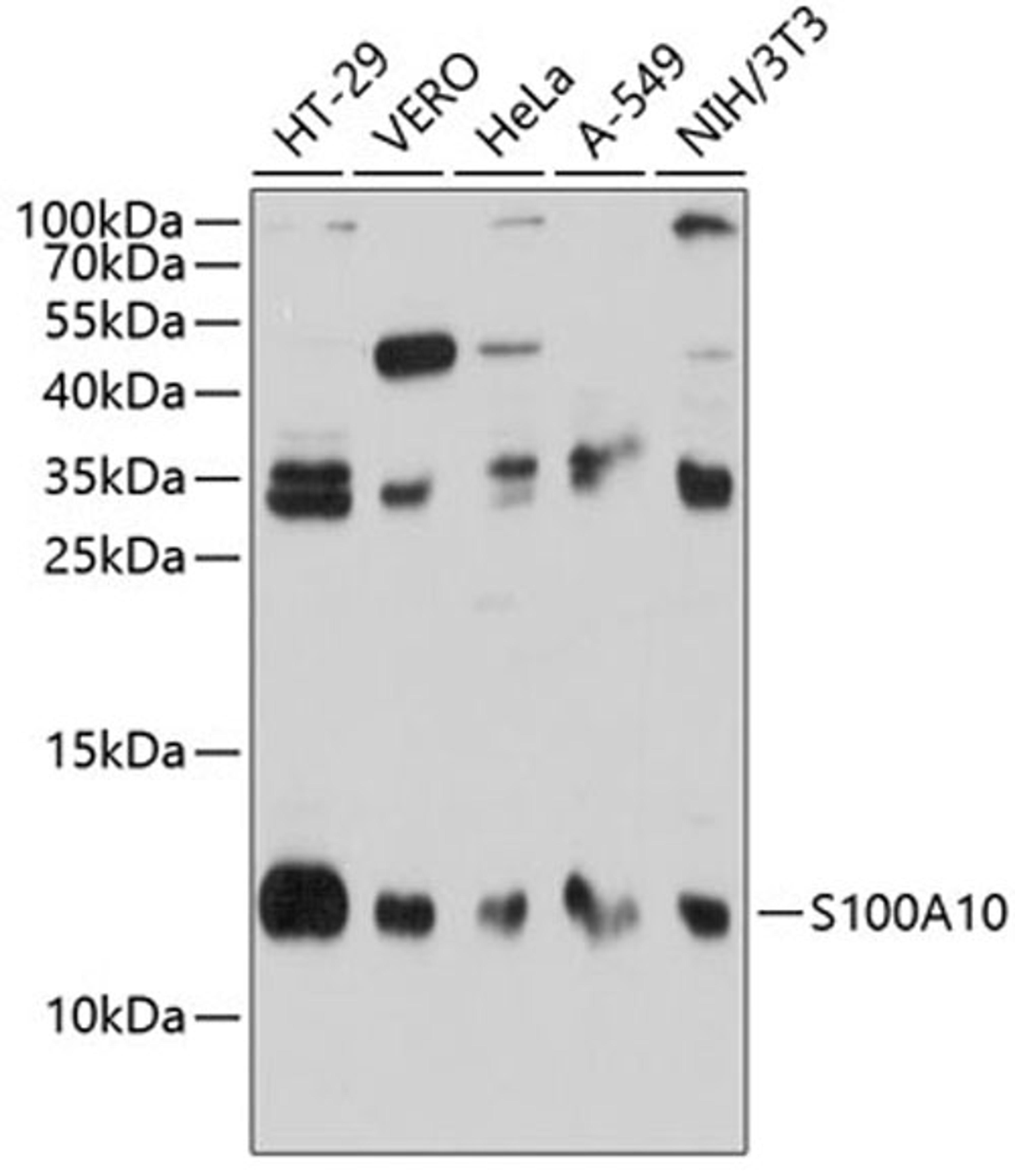 Western blot - S100A10 antibody (A14658)