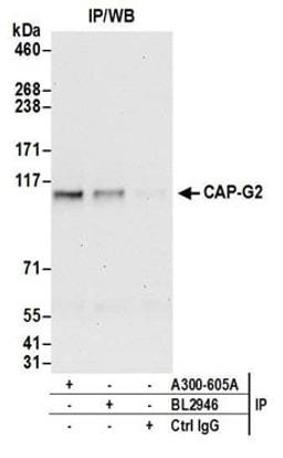 Detection of human CAP-G2 by western blot of immunoprecipitates.