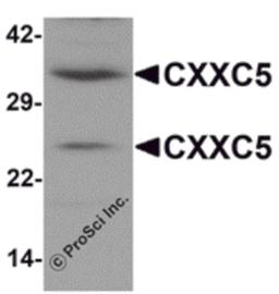 Western blot analysis of CXXC5 in human brain tissue lysate with CXXC5 antibody at 1 μg/mL.