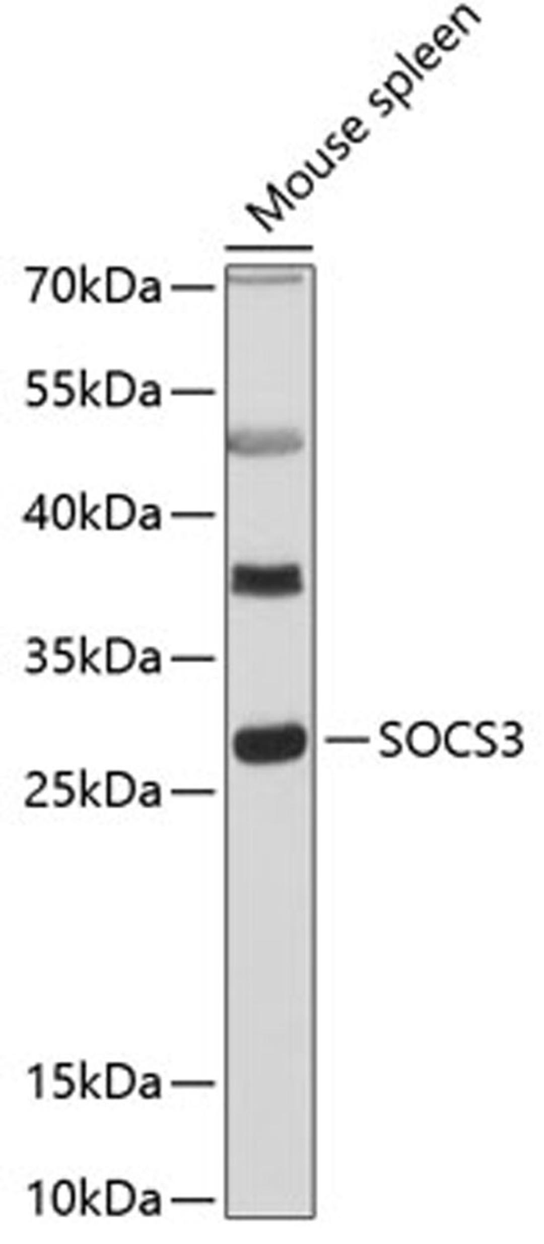 Western blot - SOCS3 antibody (A0694)