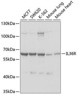 Western blot - IL1RL2 antibody (A10090)