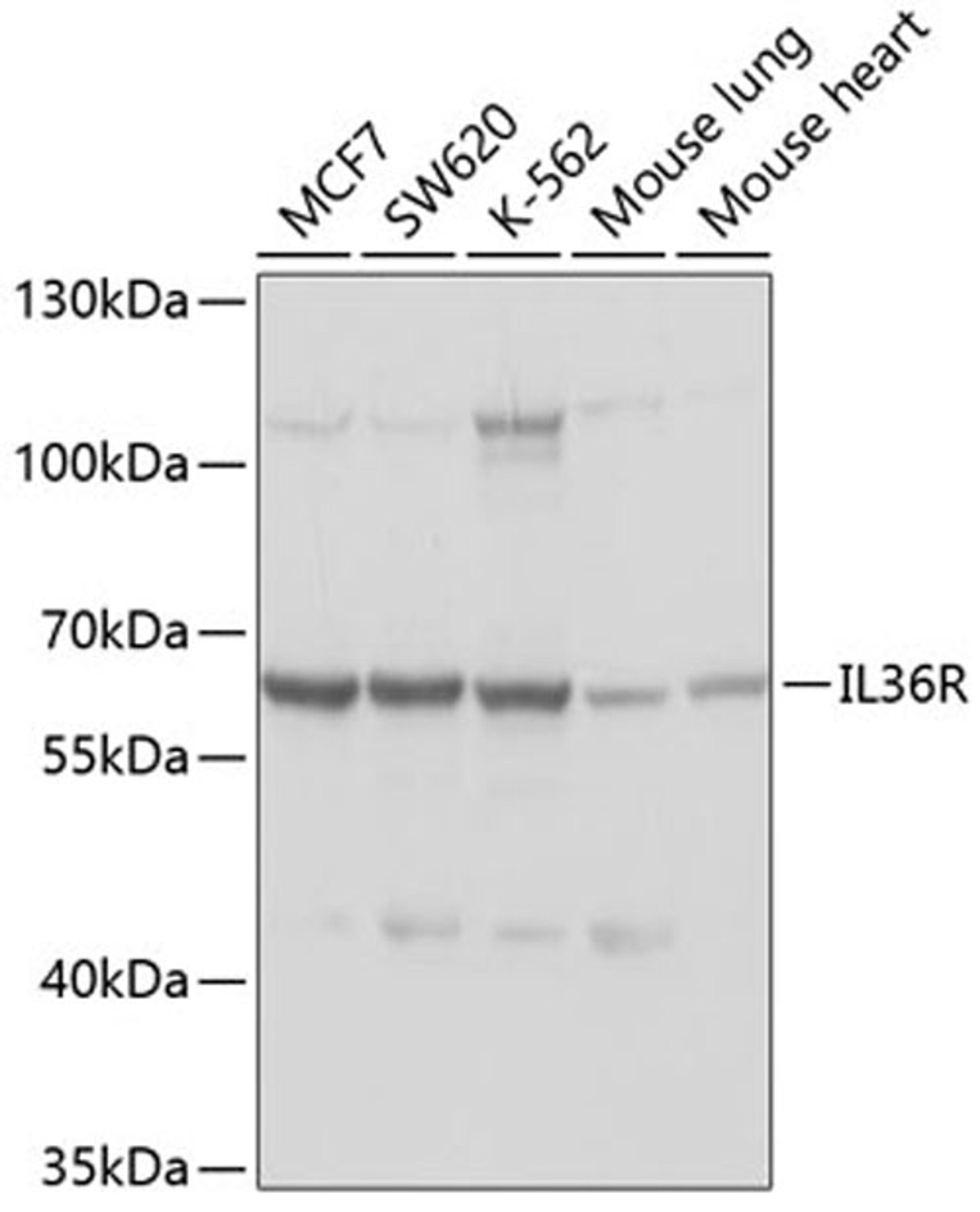 Western blot - IL1RL2 antibody (A10090)