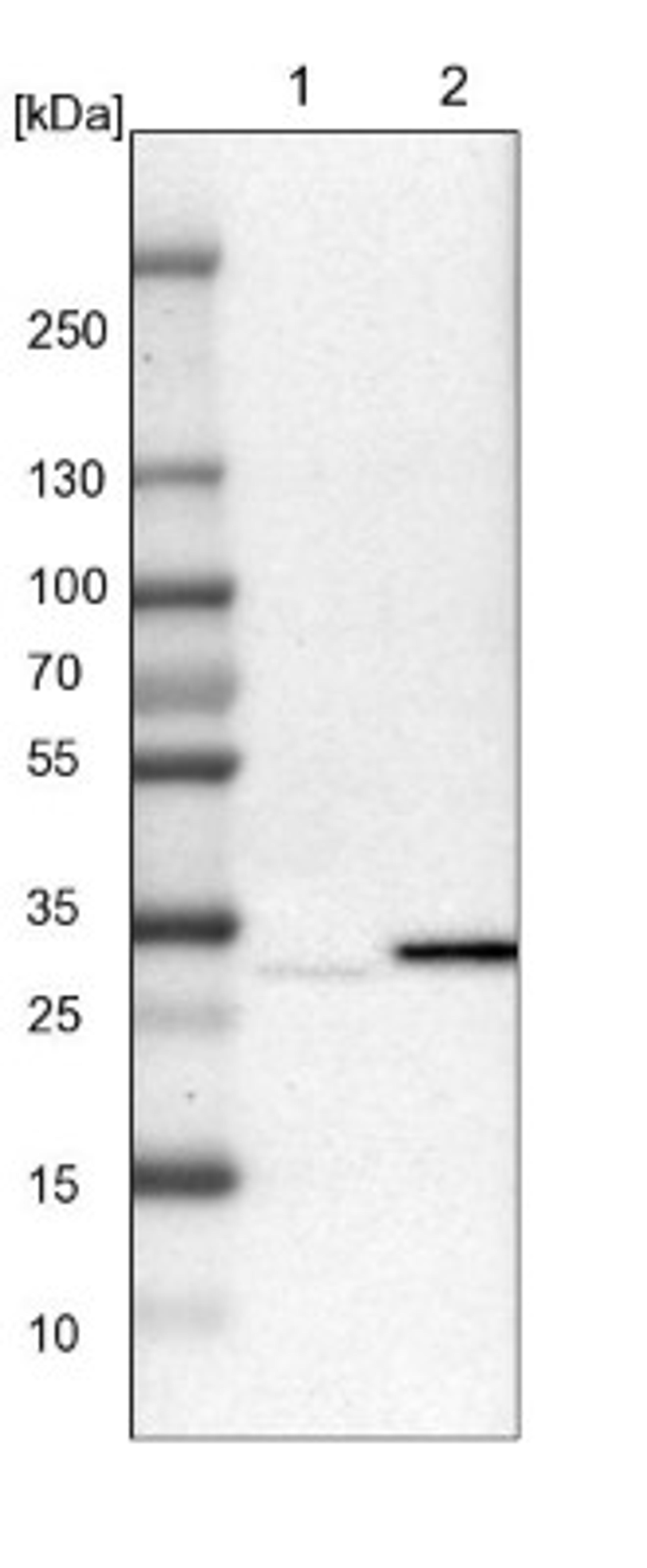 Western Blot: TATDN1 Antibody [NBP1-85733] - Lane 1: NIH-3T3 cell lysate (Mouse embryonic fibroblast cells)<br/>Lane 2: NBT-II cell lysate (Rat Wistar bladder tumour cells)