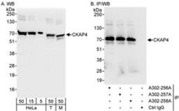 Detection of human and mouse CKAP4 by western blot (h&m) and immunoprecipitation (h).