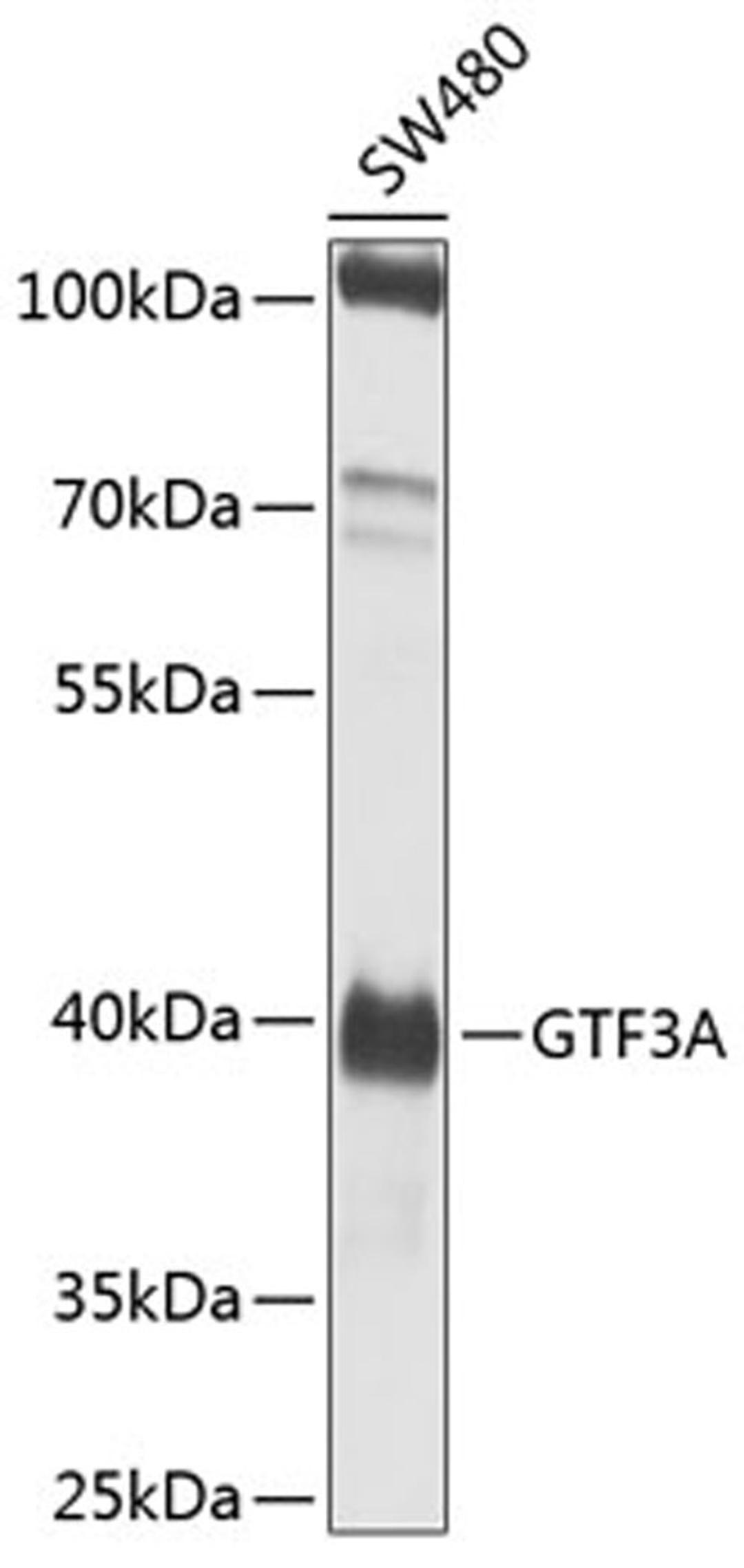 Western blot - GTF3A antibody (A8426)