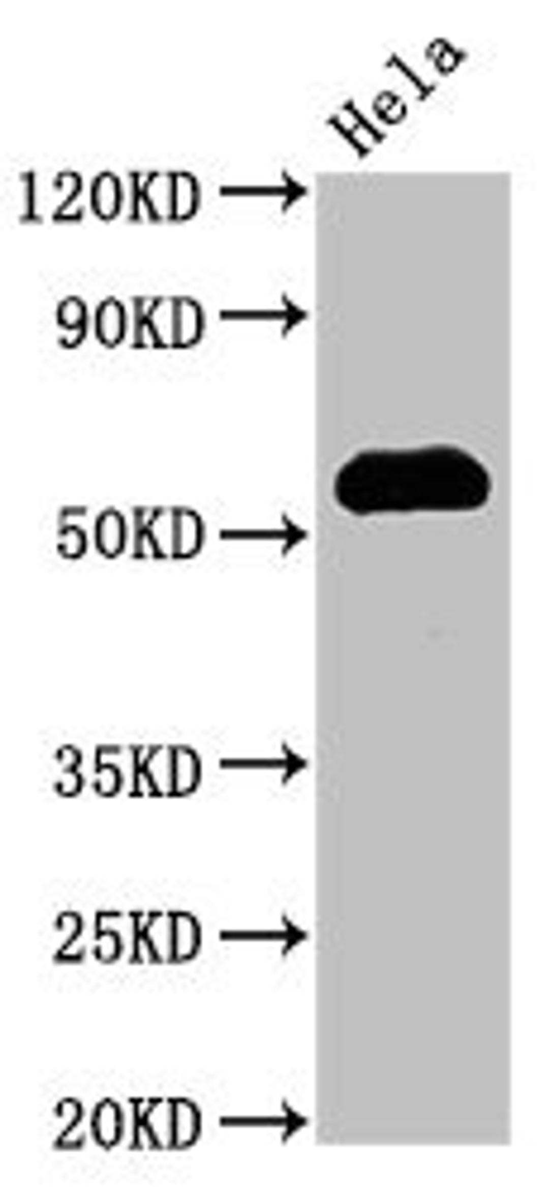Western Blot. Positive WB detected in: Hela whole cell lysate. All lanes: HSF1 antibody at 3µg/ml. Secondary. Goat polyclonal to rabbit IgG at 1/50000 dilution. Predicted band size: 58, 53 kDa. Observed band size: 58 kDa