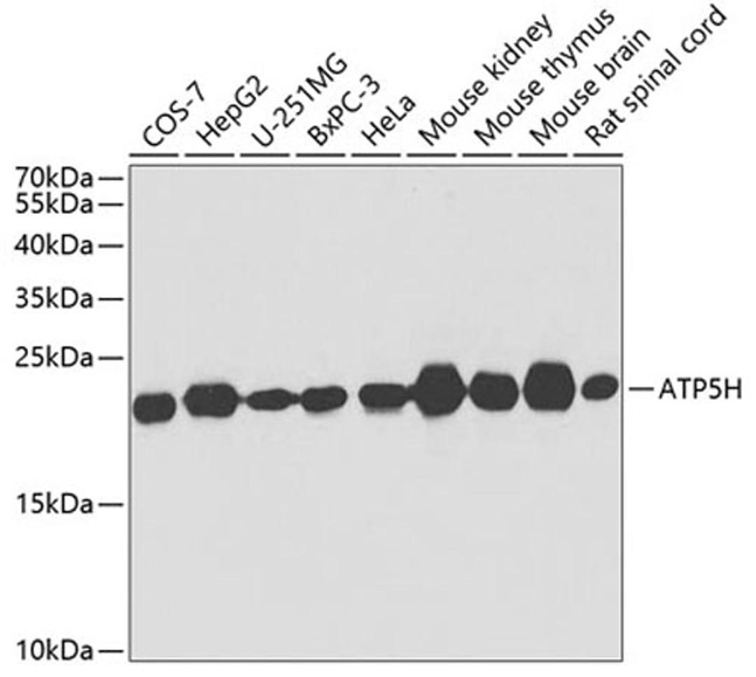 Western blot - ATP5H antibody (A4425)